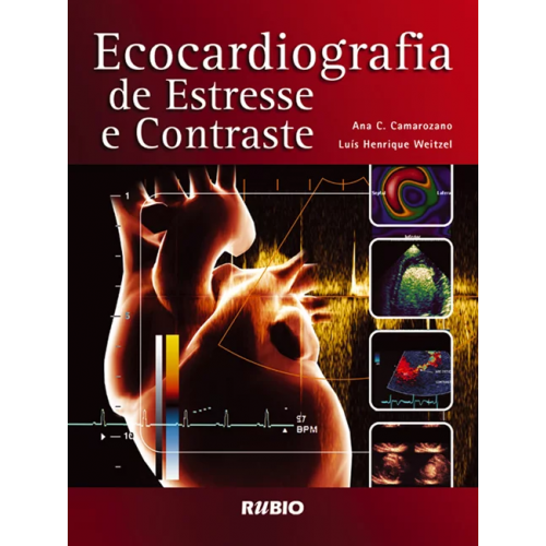 Ecocardiografia de Estresse e Contraste