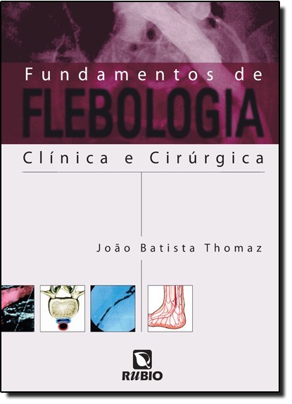 Fundamentos de Flebologia Clínica e Cirúrgica