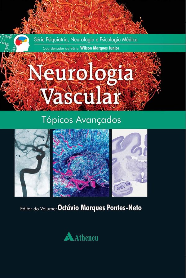 Neurologia Vascular | Tópicos Avançados