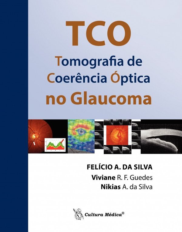 TCO Tomografia de Coerência Óptica no Glaucoma