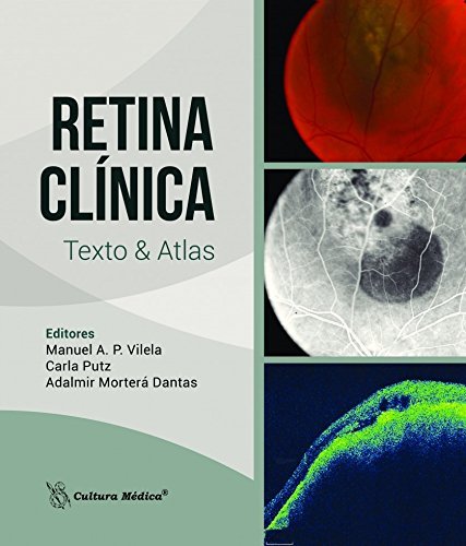 Retina Clínica | Texto e Atlas