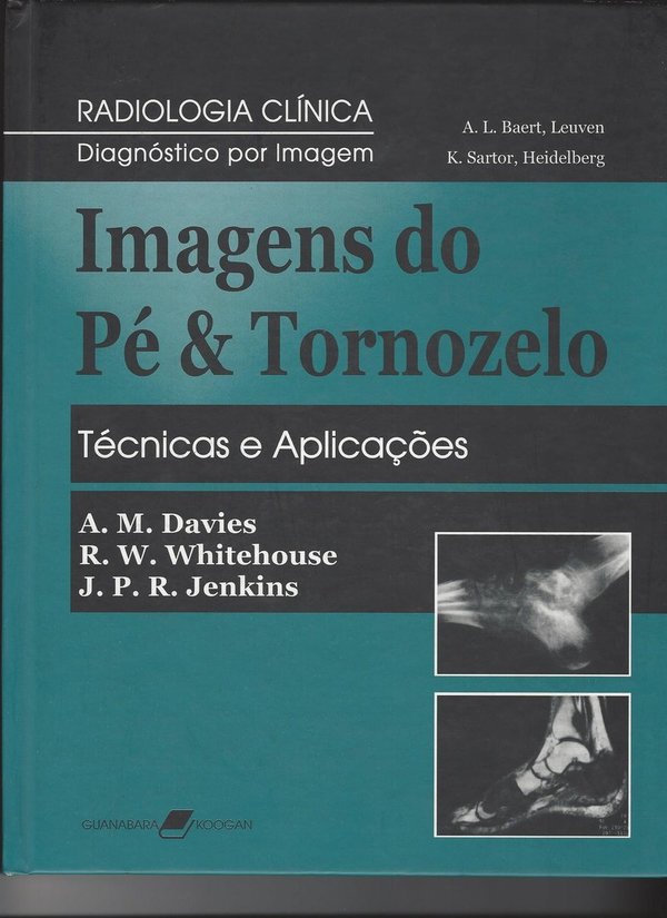 Imagens do Pé e Tornozelo | Técnicas e Aplicações
